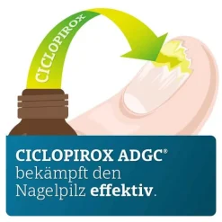 CICLOPIROX ADGC® 80 mg/g wirkstoffhaltiger Nagellack, 6.6 ml