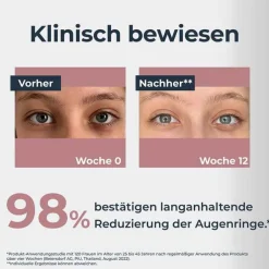 Eucerin Anti-Pigment Augenpflege Augenringe, 15 ml