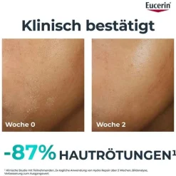 Eucerin Dermopure Clinical Hydra Repair Creme, 40 ml