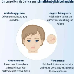 Evolsin Dellwarzen Mittel Lösung, 5 ml