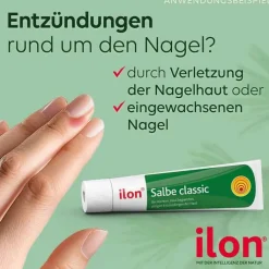 ilon® Salbe classic, 50 g