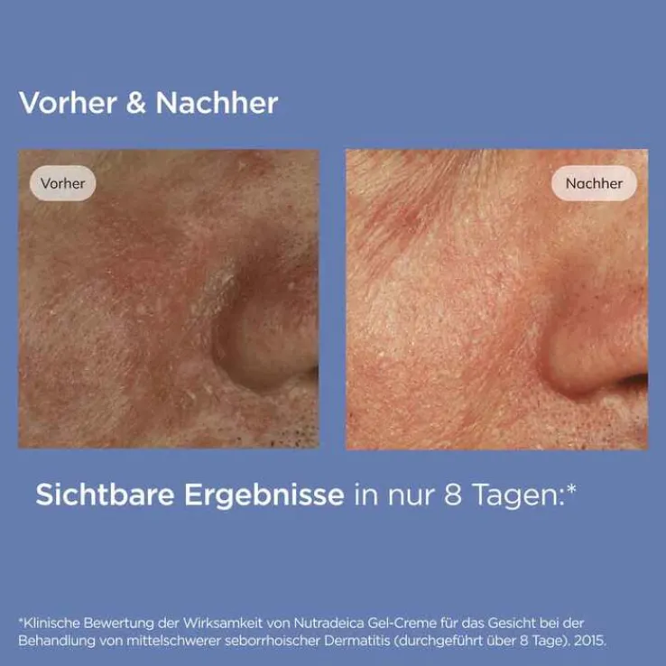 ISDIN Nutradeica Gel-Creme Gesicht, 50 ml
