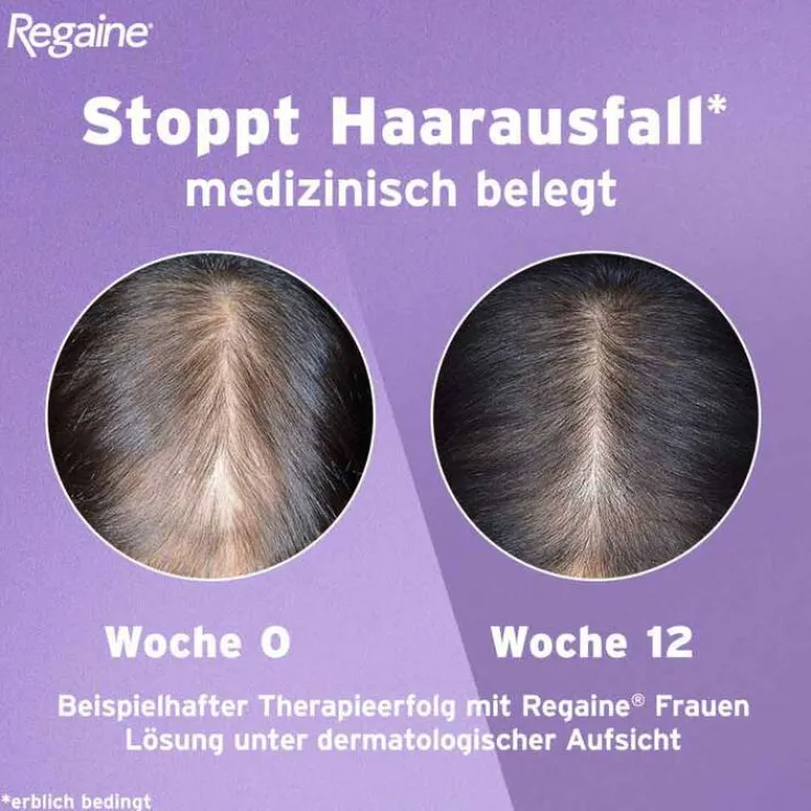 Regaine Frauen Lösung, 60 ml
