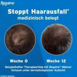 Regaine Männer Schaum 5%, 3X60 ml
