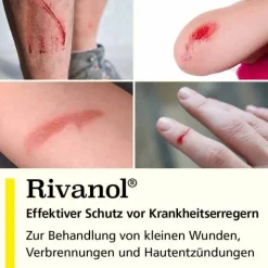 Rivanol 1,0 g Pulver, 10 St